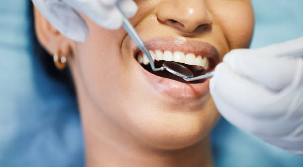 Best Emergency Dental Care for Broken or Chipped Teeth in Garfield, TX