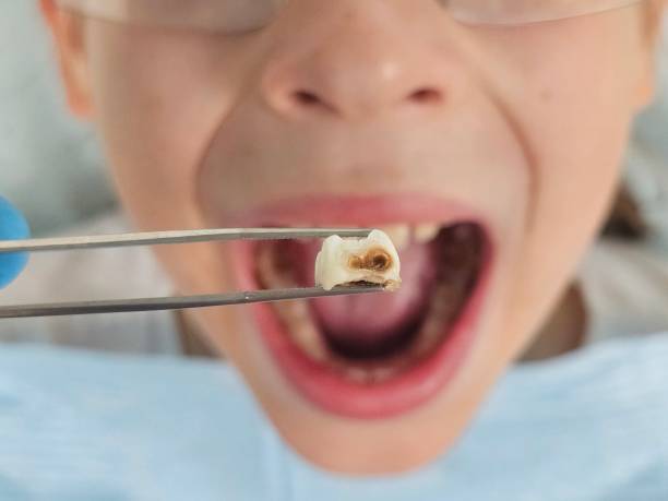 Best Emergency Denture Repair in Garfield, TX